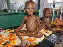  Nigeria leads malnutrition rate in Africa, second globally